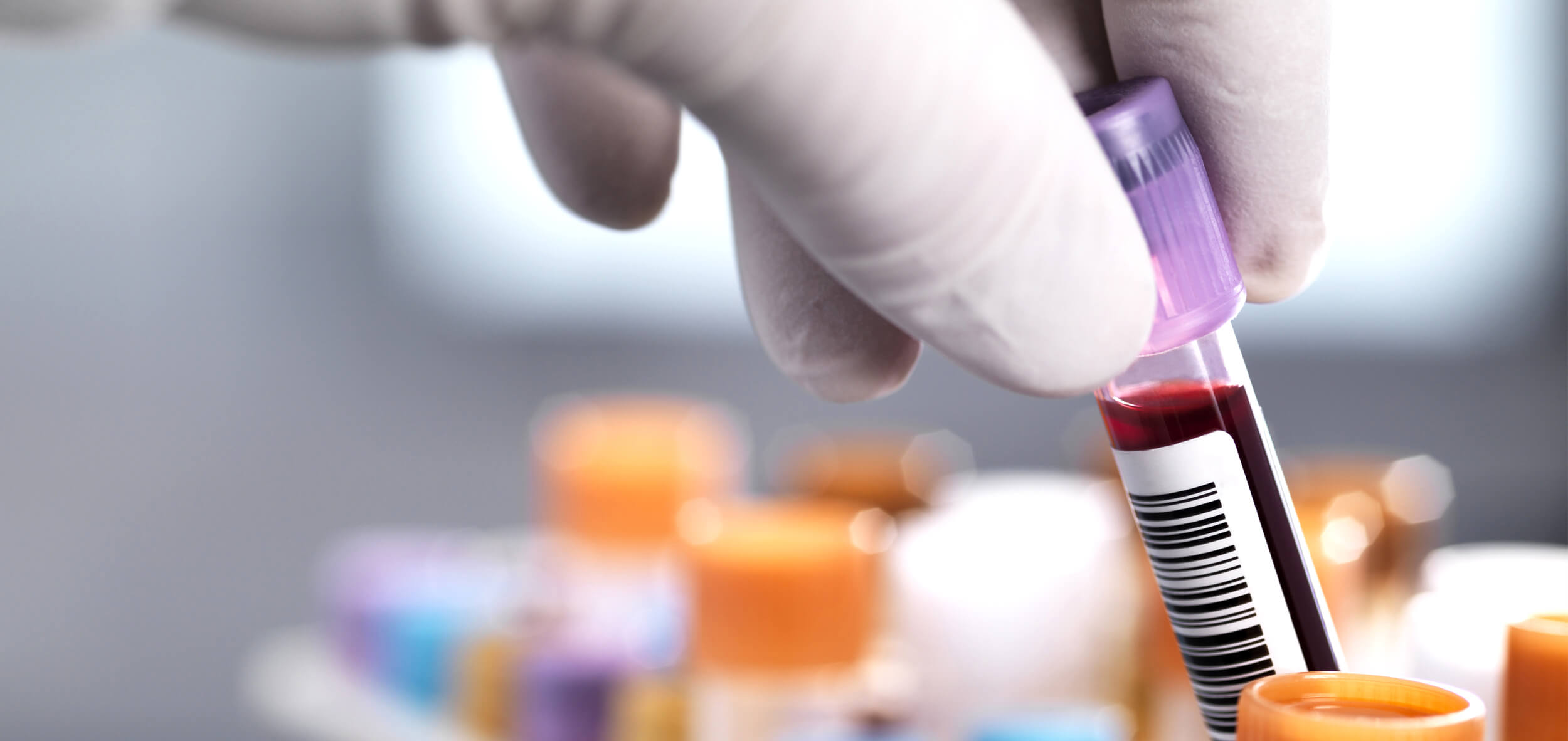 Hand holding cannula with blood for health screening